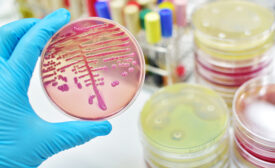 hand holding microbial, food safety